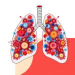 microbiota